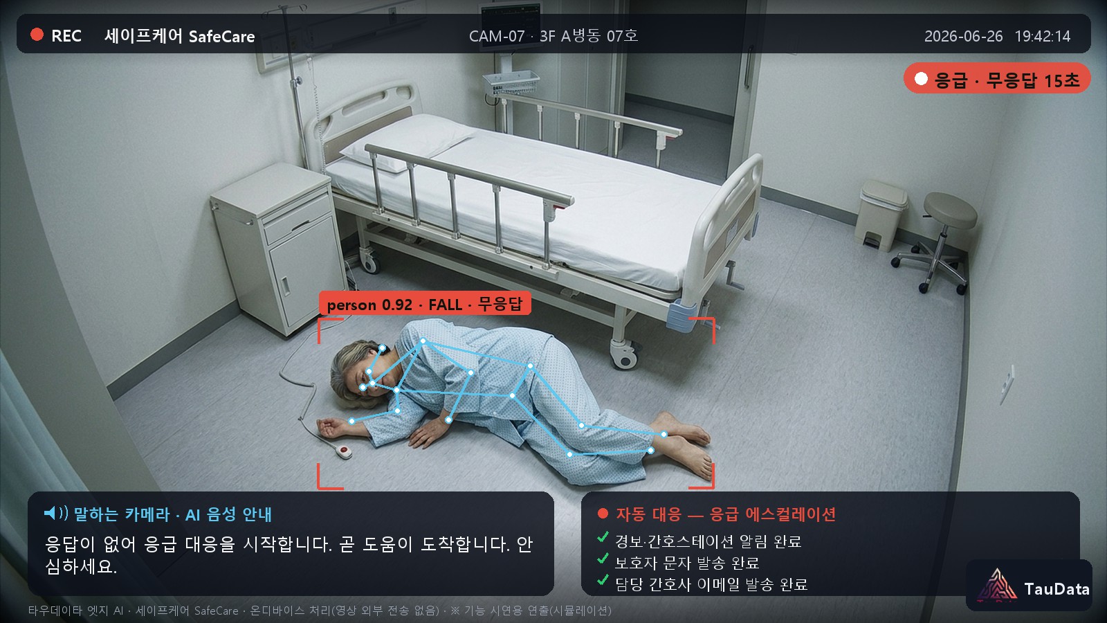 5단계 응급 에스컬레이션